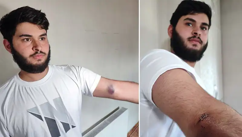 Bahçeye Kaçan Top, Mahallede Şok Etkisi Yarattı: Conolar Kamyonetle Geldi