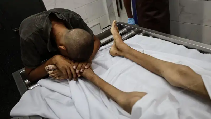 Gazze'de Çocuklar Açlıkla Sınanırken, Bir Minik Hayat Daha Kaybedildi